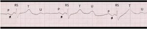Figure3