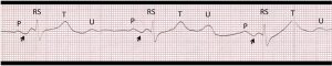 Figure3